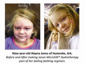 MicroSilk® Oxygen Bath Brings Arkansas Women, Business Owners Together to Develop Skin Care Support Network Absent in State